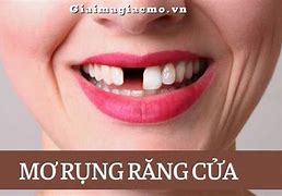 Mơ Rụng 3 Cái Răng Đánh Con Gì